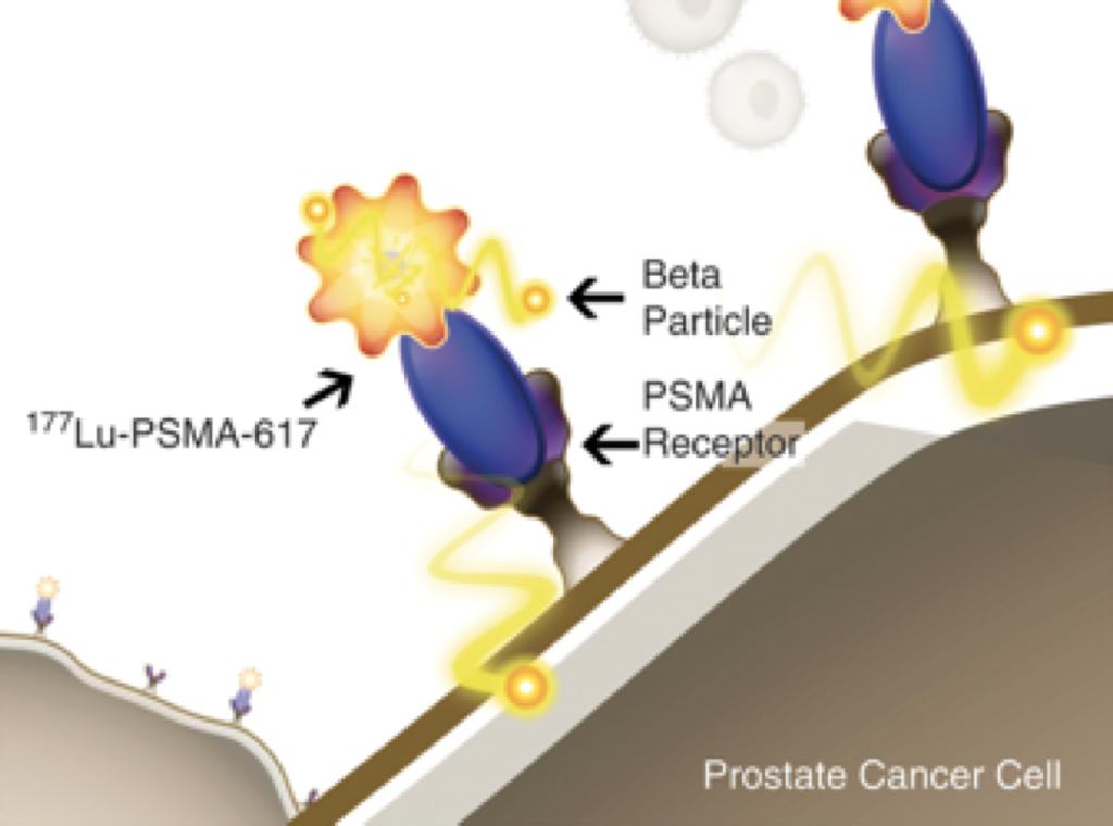 Endocyte s Lutetium-PSMA-617 Targeted Brachytherapy for Prostate Cancer PSMA-617 is a pep2de that recognizes and targets prostate specific membrane an2gen (PSMA).