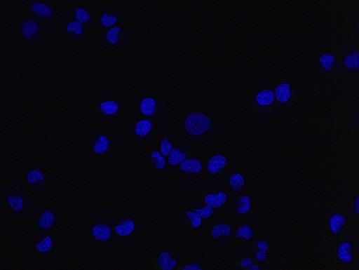 cells that had been treated