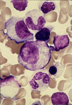A B C D A : Picture of bone marrow