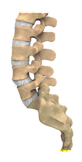 This condition can cause impingement of the spinal nerves and/or fatigue of the