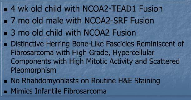 mo old male with NCOA2-SRF Fusion 3 mo old child with
