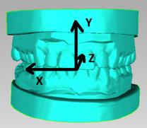 stl For screw-retained restorations the zip package also includes a file with the screw access channel: <caseno>-upper-sac.stl <caseno>-lower-sac.