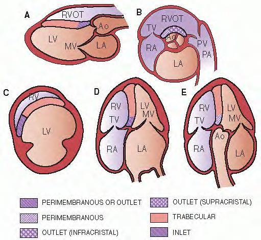 Adel Hasanin Ahmed 2 The interventricular septum has two parts: the muscular septum and the thinner, fibrous membranous septum (which lies just below the aortic valve).