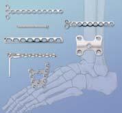 7 mm straight, condylar and T-plates Low-profile: designed to reduce soft tissue irritation LCP Pilon Plate Can be cut and contoured for anatomic