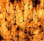 Enter the neuron ( brain cell ) Cerebrum/Cerebral Cortex Thalamus ~40 m A Pyramidal
