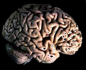 Four anatomically distinct lobes Occipital Parietal