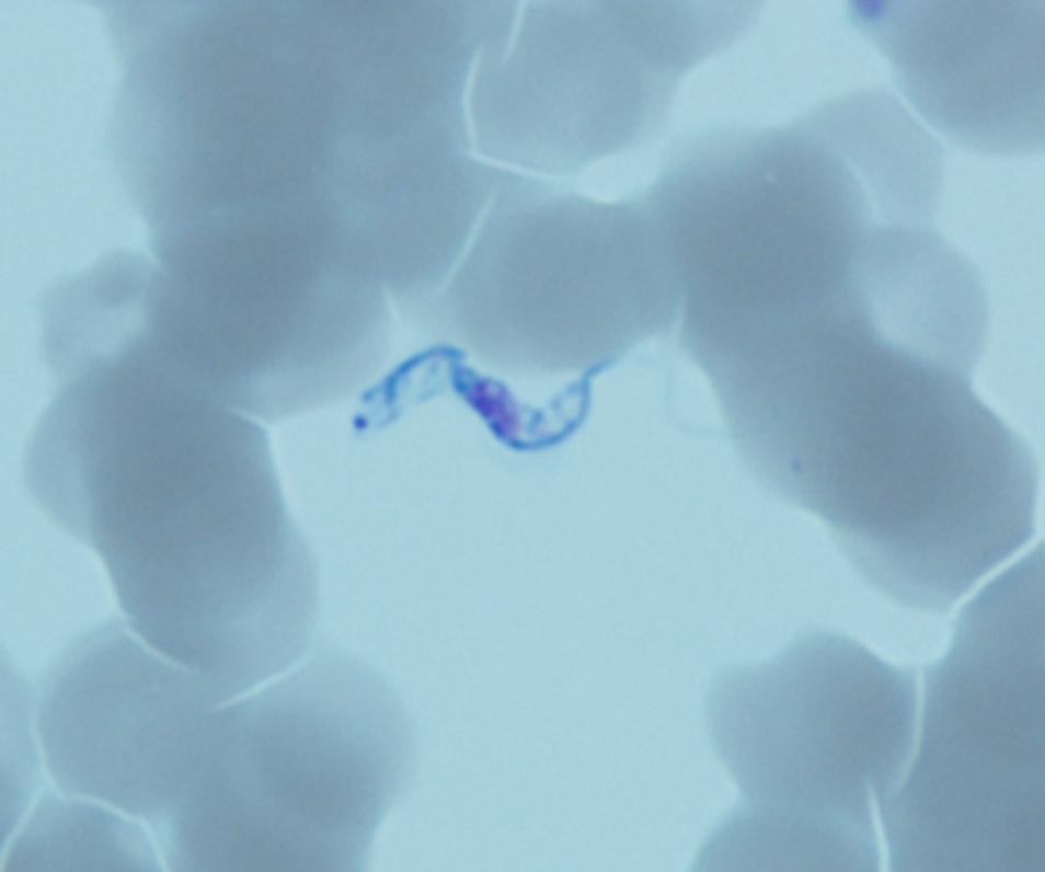 14B-F Correct Identification: Trypanosoma brucei Trypanosoma brucei 21/21 100 10/10 Correct Parasites Seen 3/3 100 10/10 Correct Quality Control and Information All participating and referee