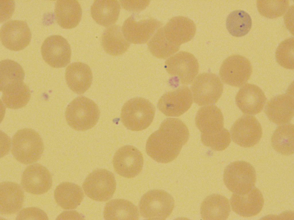 14B-I Correct Identification: Babesia species Babesia species 21/21 100 10/10 Correct Parasites Seen 3/3 100 10/10 Correct Quality Control and Information All participating and referee laboratories