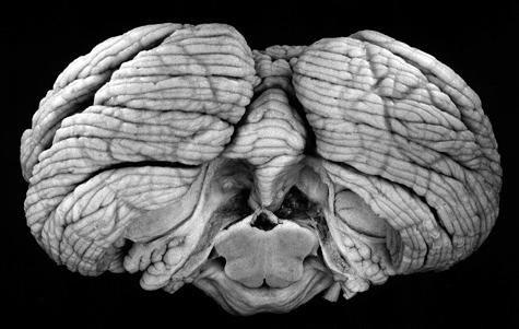 vermis hemisphere floculo-nodular lobe