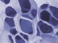 Interconnected porosity Mimics the trabecular structure of human cancellous bone and allows new bone regeneration