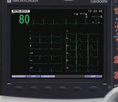 Sustaining Life Post Cardiac Arrest Management Decision support of cardiac arrest care 12-lead ECG is mandatory required to find STEMI patient