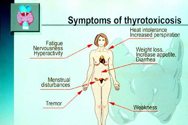 Thyroid Peroxidase I +* Iodotyrosine Thyroglobulin ECF