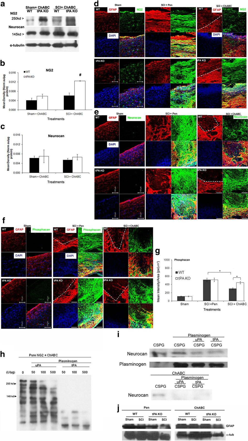 Bukhari et al. Axonal Growth via ChABC and tpa/plasmin System J. Neurosci., October 19, 2011 31(42):14931 14943 14937 Figure 4.