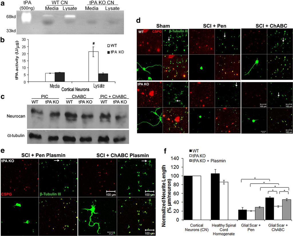 Bukhari et al. Axonal Growth via ChABC and tpa/plasmin System J. Neurosci., October 19, 2011 31(42):14931 14943 14939 Figure 5.