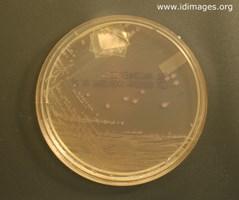 Laboratory Diagnosis: All Shigella species are readily isolated using selective media (eg, Hektoen enteric agar).
