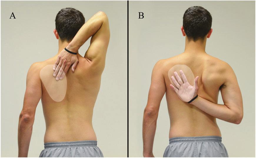 6A). This tests abduction and external rotation. Next, ask the patient to reach behind the back and touch the bottom of the scapula (Figure 1.6B).