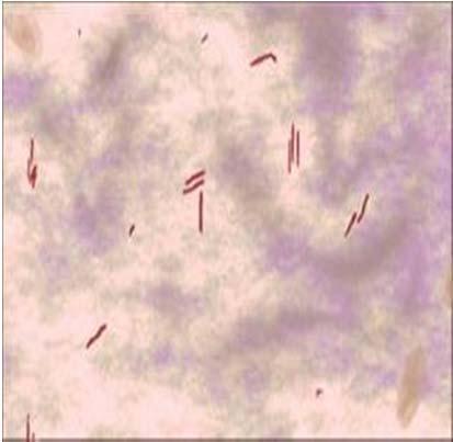 used to demonstrate the presence of the bacilli in a smear The technique is simple, inexpensive