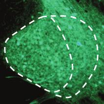 b, HSVGFP injection to reveals retrograde labeling of CEl neurons detected with antigfp