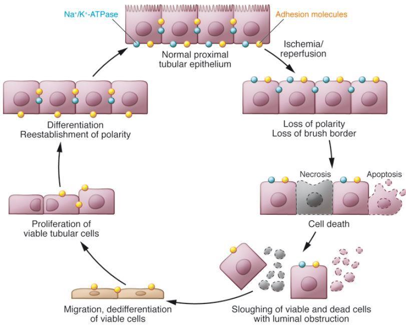Damage and Repair Cycle of Tubular Epithelial Cells