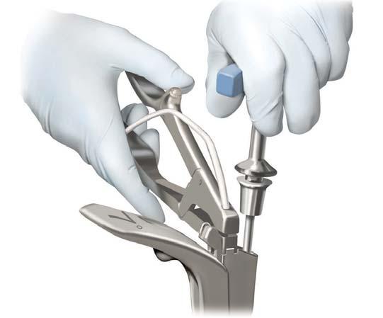Note: Ensure that the 7 Dynesys Glide Instrument is properly seated on the pedicle screw. Note: Remove any soft tissue present that may impede set screw placement.