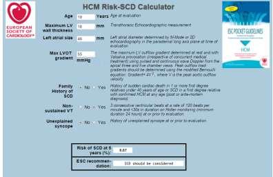 Estimation of SCD risk in HCM Risk stratification of patients with HCM using 2D speckle tracking echocardiography Speckle tracking echocardiographic LV strain analysis has demonstrated to correlate