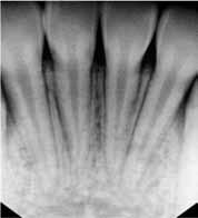 figure 5. Radiograph displayed in the Denticon electronic dental record.