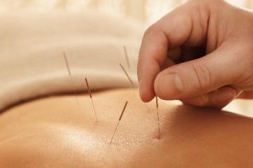 The treatment with herbs and acupuncture started on 18 th of February 2014, without doing the chemotherapy and radiotherapy.