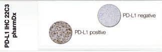 Slide Evaluation General Considerations PD-L1 IHC 22C3 pharmdx evaluation should be performed by a qualified pathologist using a light microscope of diagnostic quality.