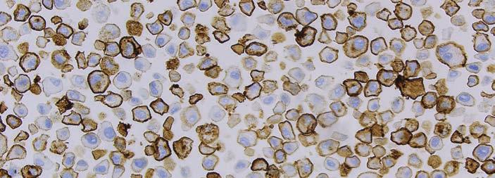 acceptable staining of PD-L1 IHC 22C3 pharmdx Control Cell Line Slide (20 magnification).