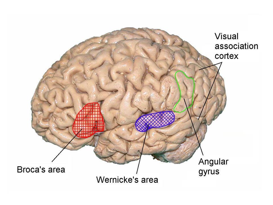 Wernicke s aphasia: Persons with Wernicke s aphasia can produce many words and they often speak using grammatically correct sentences with normal rate and prosody.