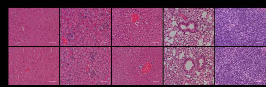 Figure S8. Histological analysis of major organs (heart, kidney, liver, lung, and spleen) after treatment of -TT3 hfix.
