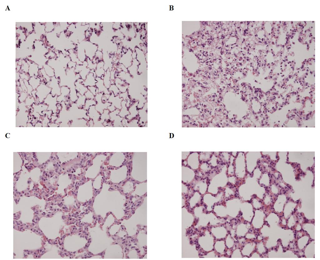 The role of the vagus nerve in LPS-induced acute lung injury E Figure 3: Lung morphology Representative histological sections of the lungs were stained with H&E at x400 11 magnification A: In the