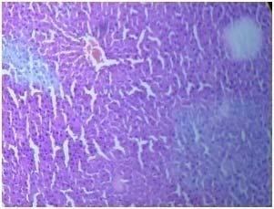 Fig.No.5 Section of rat liver treated with aqueous extract of Tephrosia purpurea (75mg/kg) and CCl 4 treated shows regeneration of hepatic cells, central vein, nucleus, endothelium and sinusoids.