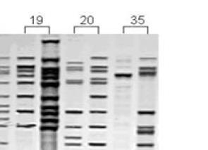 TB Genotyping: Current status Genetic analysis of Mycobacterium tuberculosis DNA using molecular techniques to produce a digital signature or DNA fingerprint: RFLP (no longer