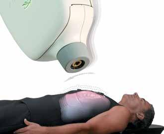 CyberKnife System, along with the Synchrony Respiratory Tracking System, provide the