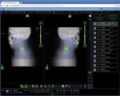 parallel tasking and visual workflow guidance Fast Treatment Planning -Anatomy-specific auto-segmentation