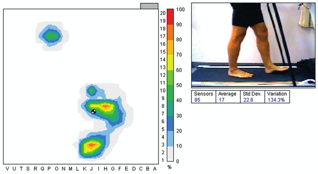 FSA Clinical Foot Assessment Orthotest Mat Length Mat Width Mat Area (m2) Sensing area length Sensing area width (m2) 58 58 0.33 35 35 0.