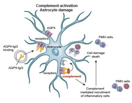 The Role of Complement in NMOSD Complement Activation in NMOSD AQP4-specific antibody (IgG) binds to AQP4 astrocyte protein triggering complement activation Immune activation through complement leads