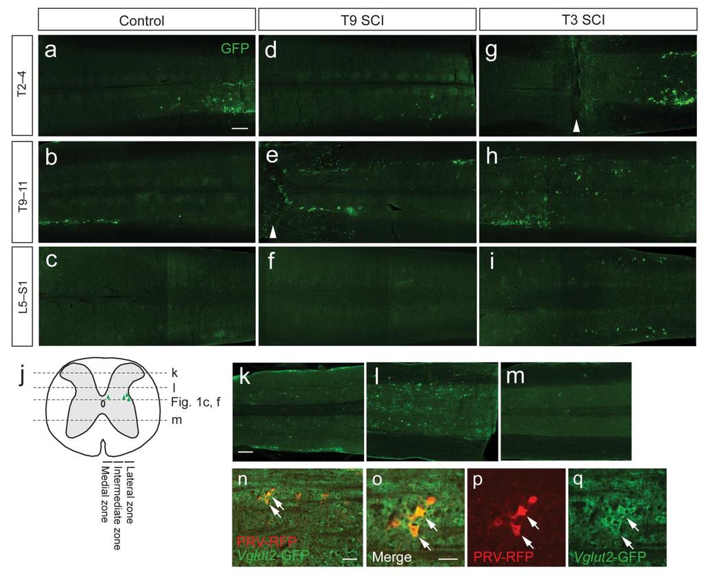 Supplementary Figure 3 PRV + spinal sympathetic neurons innervating the spleen in control and SCI mice.