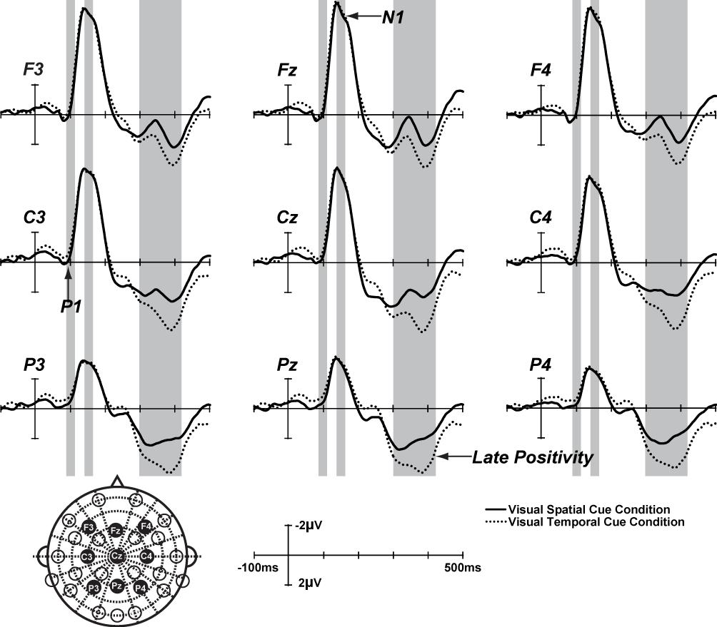 CHAPTER 3 MODULATION OF AUDITORY PROCESSING BY SPATIAL OR TEMPORAL CUE conditions were characterized by a P1 (peaking approximately 100ms post-stimulus) with a temporal scalp distribution, an N1