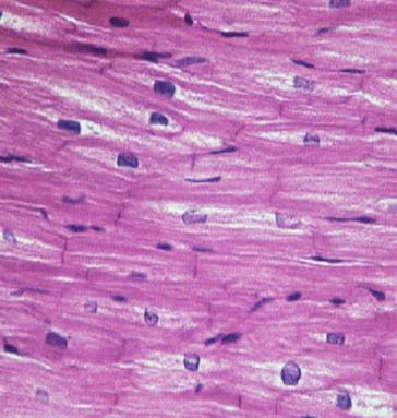 peristalsis Cardiac muscle Main muscle of heart Heart muscle cells behave as one