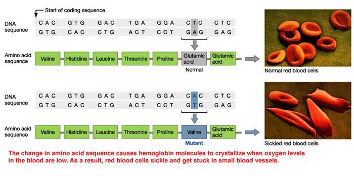 Sickle Cell Anemia Genetics: HbS is produced by the substitution of valine for glutamic acid at the sixth amino acid