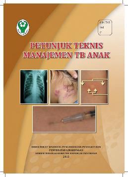 Situation of child TB in Indonesia A child TB working group (2005), consists of: NTP The