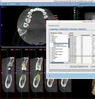 INTEGRATE WITH DIGITAL IMAGING, EXPAND YOUR DIAGNOSTIC CAPABILITIES RESTORATIVE-D Scan the edentulous