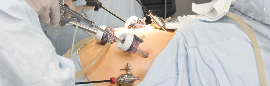 Laparoscopic Colorectal Surgery Low rates of laparoscopic surgery in NSW 20.