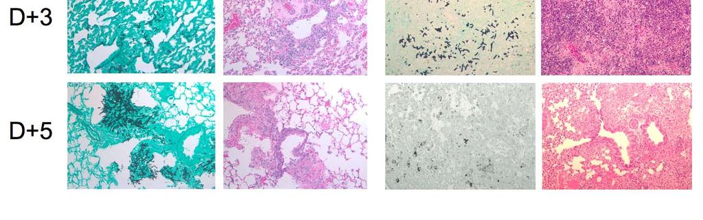 Steroid Immunosuppressed Mice with IPA High fungal burden,
