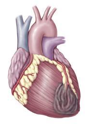 2. CARDIOVASCULAR DISEASE Cardiovascular disease is a general term that refers to diseases of the heart and blood vessels.