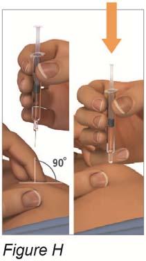 slight bulge or fold. (see figure G). Step 7: Give Your Injection a) Hold the PLEGRIDY pre-filled syringe at a 90 angle to the injection site.