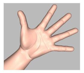 Unit 1: Normal Hand Anatomy Introduction To learn more about Duputytren's Contracture, it is important to understand