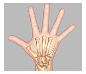 Unit 1: Normal Hand Anatomy The wrist is comprised of 8 bones called carpal bones. These wrist bones connect to 5 metacarpal bones that form the palm of the hand.